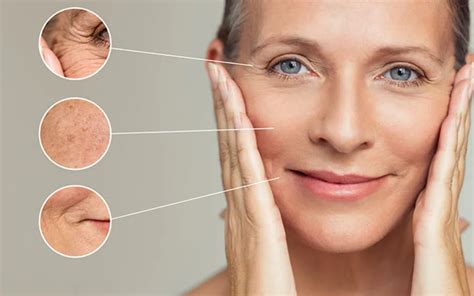 Does Dry Skin Cause Wrinkles Things To Know After Sybil