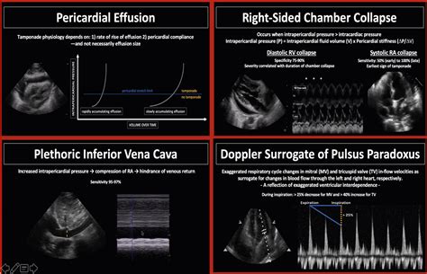 EmDOCs Net Emergency Medicine EducationUS Probe When Does An