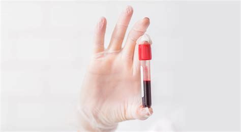 Handling Blood Samples 5 Good Practices