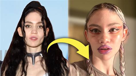 Grimes Admits To Plastic Surgery Is This The Start Of The New