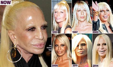 How Donatella Versace Transformed Herself Into A Human Waxwork With Botox Implants And Laser