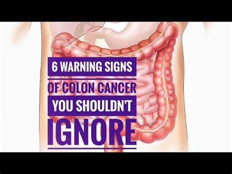 6 Signs And Symptoms Of Colon Cancer You Should Not Ignore 6 Warning