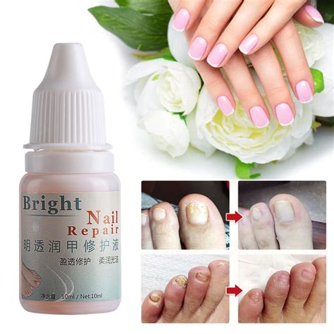 10ml Fungal Nail Treatment Gel Whitening Toe Nail Care Essence Anti
