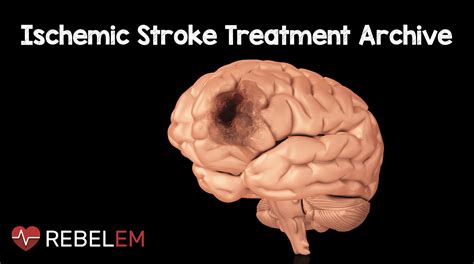 Ischemic Stroke Treatment Archive Rebel Em Emergency Medicine Blog