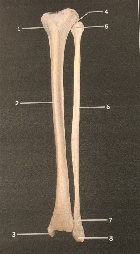 Left Articulated Tibia And Fibula Anterior View Diagram Quizlet