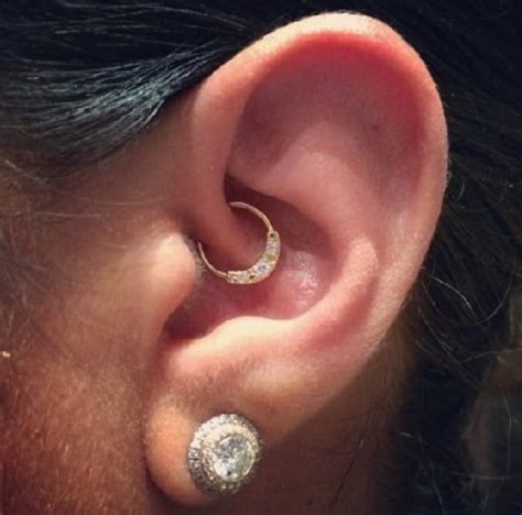 Ear Piercing Leaves Teen With Keloid Scar