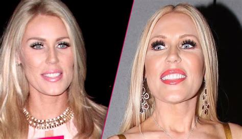 Gretchen Rossi Plastic Surgery With Before And After Photos