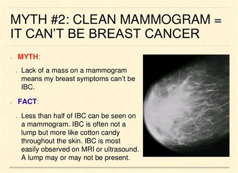 Inflammatory Breast Cancer Symptoms Pictures Cancerwalls