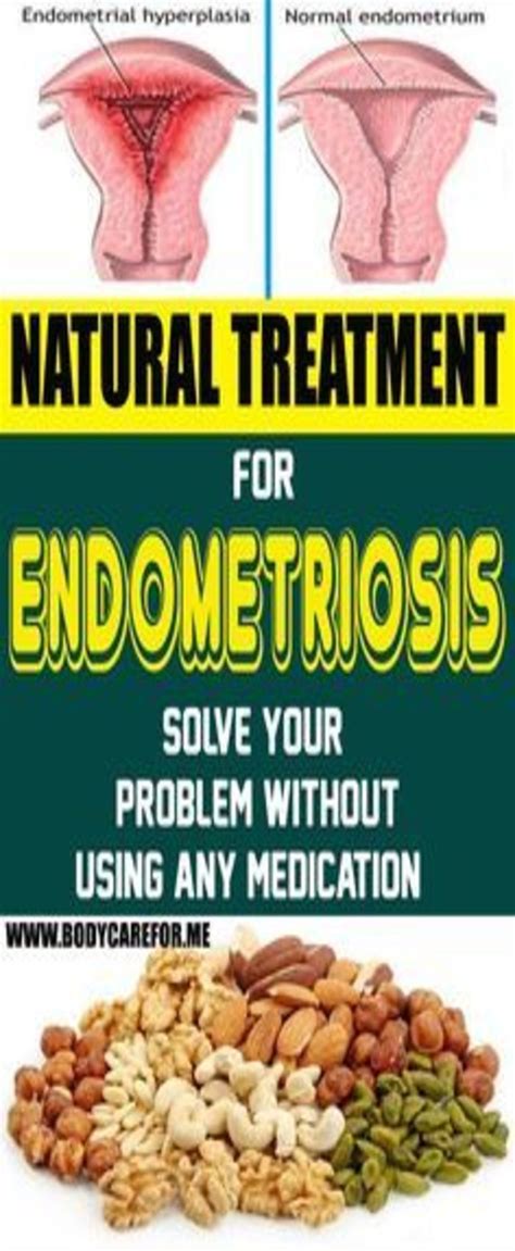 Ten Easy Home Remedies To Get Rid Of Hemorrhoids Endometriosis Endometrial Hyperplasia