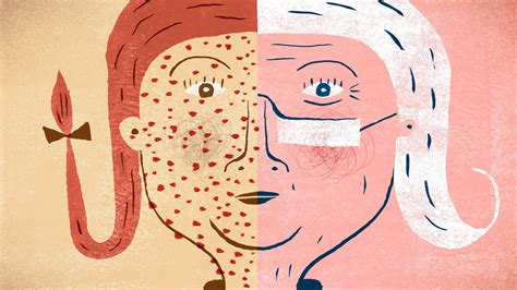 No Excuses People Get The New Shingles Vaccine The New York Times