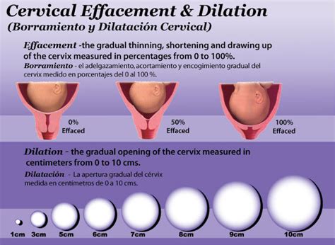 We did not find results for: thunder bear and wren: Midwife's Appointment : Dilated and ...