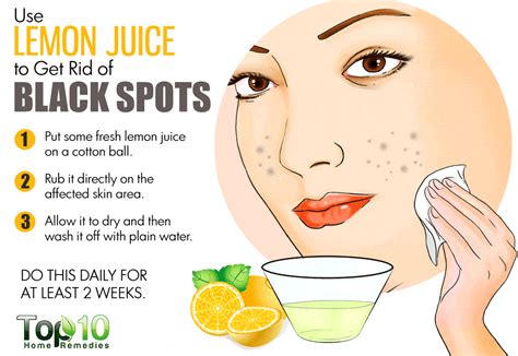 Home Remedies For Black Spots On Face Top 10 Home Remedies