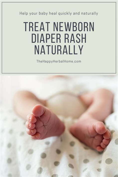 How To Heal Diaper Rash Quick New Ternds