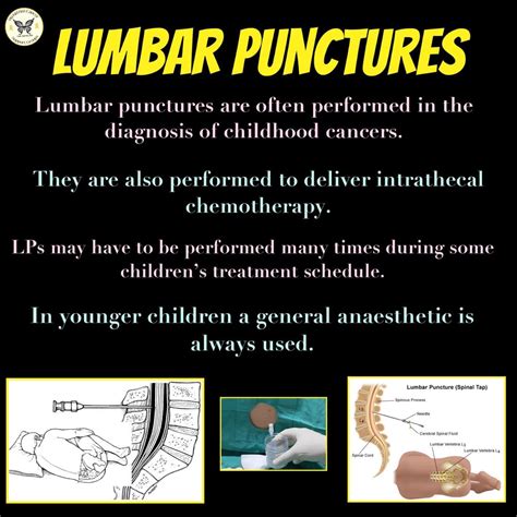 Lumbar Puncture Procedure Day The Amazing Noah