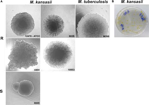 Frontiers A Murine Model Of Mycobacterium Kansasii Infection