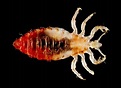 Bed Bug Pictures Of Body Lice And Scabies | Another Home Image Ideas