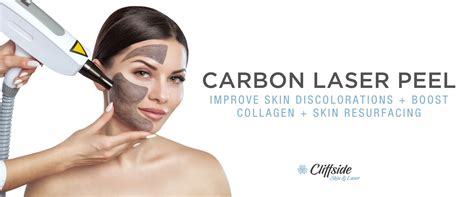 Carbon Laser Peel Cliffside Skin And Laser Cliffside Nj