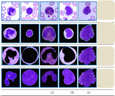 Five Types Of Wbc Cell Neutrophil Lymphocyte Eosinophil Monocyte