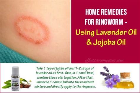 Home Remedies For Ringworms Know Before You Go Trendytarzan