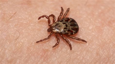 Oklahoma Woman Develops Meat Allergy After Being Bitten By A Tick