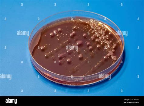 Bacterial Colonies On Macconkey Agar Plates Stock Photo Alamy