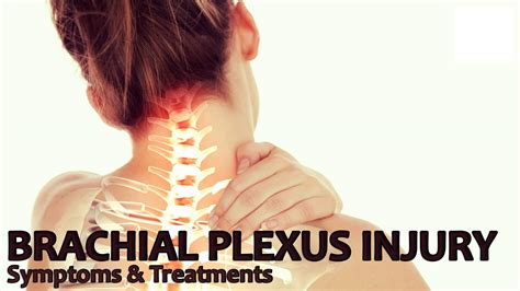 Brachial Plexus Injury At Birth Causes Symptoms And Treatment