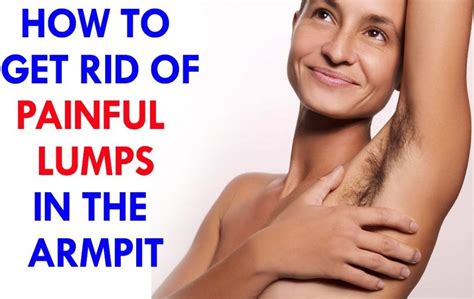 Home Remedies To Get Rid Of Painful Lumps In The Armpit Yabibo