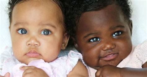 Twins With Different Skin Color