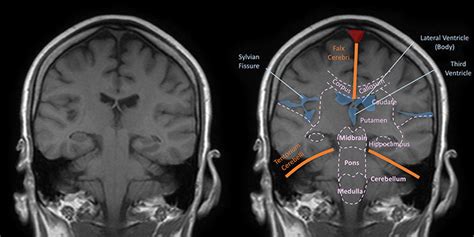 Head And Spine Anatomy Radiology Cafe