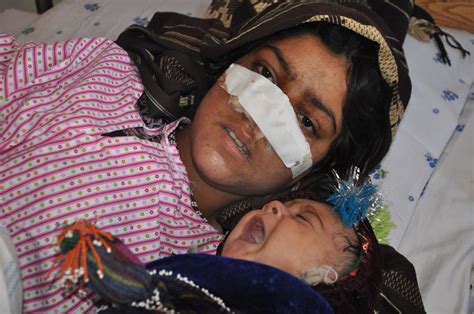 afghanistan man cut off wife s nose when she protested his plans for second marriage to a six