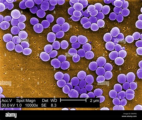 Under High Magnification Of 10000x This Scanning Electron Stock Photo