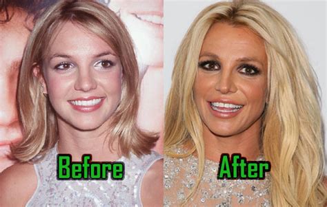 Britney Spears Plastic Surgery Behind Her Unusual Look Before After