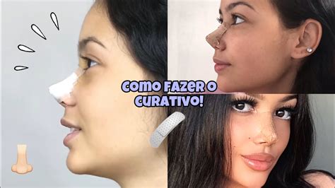 Como Fazer O Curativo Da Rinomodela O Definitiva Youtube