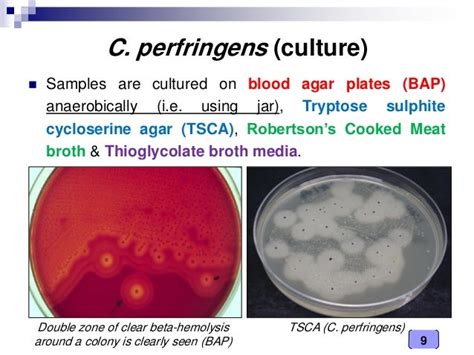 Clostridium Perfringens On Blood Agar Free Picture Photograph Shows