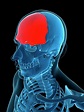 Frontal Bone Photograph by Sciepro/science Photo Library - Pixels