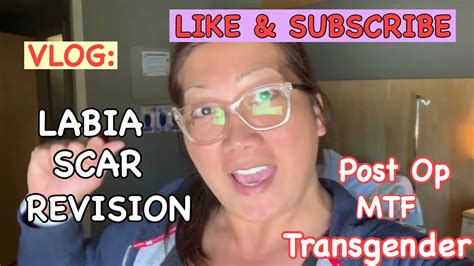 Vlog Labia Scar Revision Post Op Transgender Woman Sex Reassignment Surgery Srs Youtube