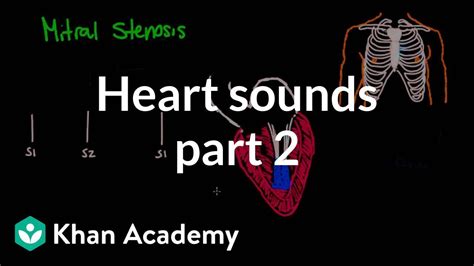 Systolic Murmurs Diastolic Murmurs And Extra Heart Sounds Part 2