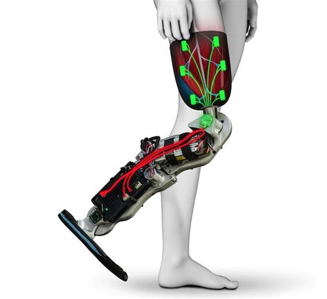 The Future Of Prosthetics Could Be This Brain Controlled Bionic Leg