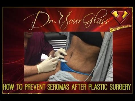 Scarring, pain, swelling and other issues may occur after a tummy tuck. Liposuction, Tummy Tuck, Seromas After Surgery Houston-Dr ...