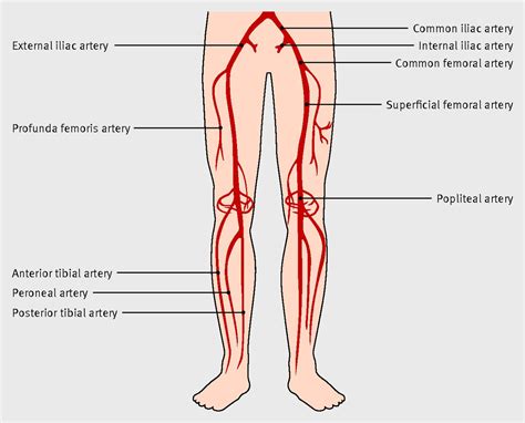 Diagnosis And Management Of Peripheral Arterial Disease The BMJ