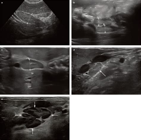 Feline Abdominal Ultrasonography Whats Normal Whats Abnormal