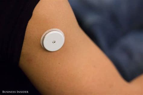 This Wearable Monitors Your Blood Glucose Levels In Real Tim
