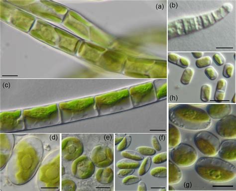Filamentous And Examples Of Coccal Algae From Forest Bscs Algae With