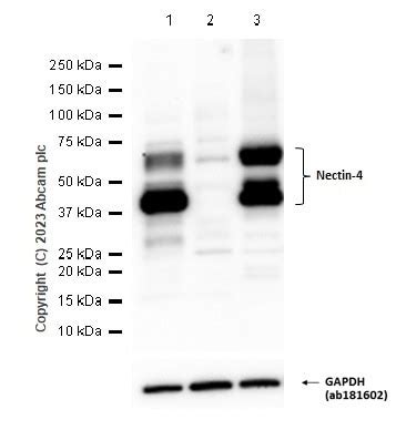 Recombinant Anti Nectin 4 Antibody EPR15613 Ab189514 Abcam