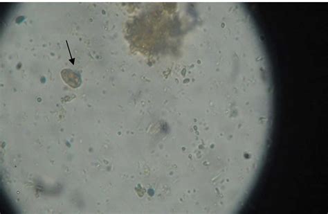 Giardia Lamblia Trophozoite Under Microscope Micropedia