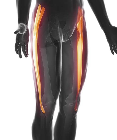 Itb Syndrome Iliotibial Band Syndrome Treatment Pain Cause Exercises