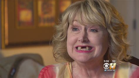 Woman Wakes Up From Minor Surgery With Front Teeth Missing Youtube