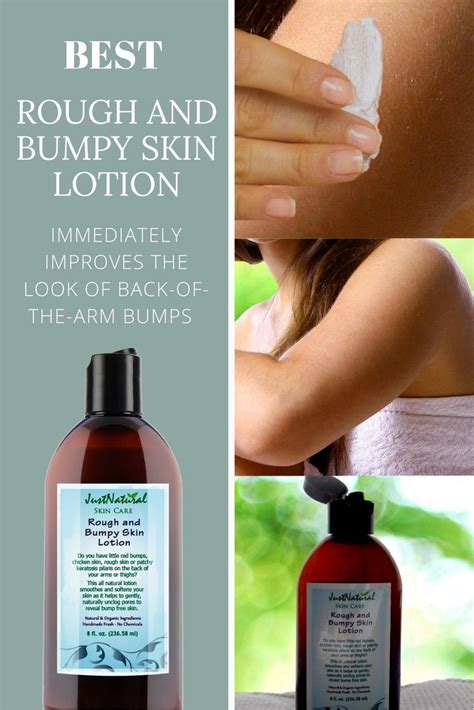 Rough And Bumpy Skin Lotion You Can Finally Treat Those Annoying Back