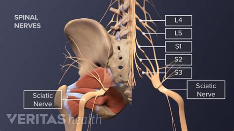 Challenges In Diagnosing The Cause Of Sciatica Spine Health