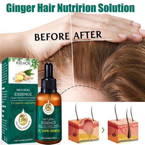 Ginger Hair Growth Essential Oil Serum Anti Loss Products Fast Grow